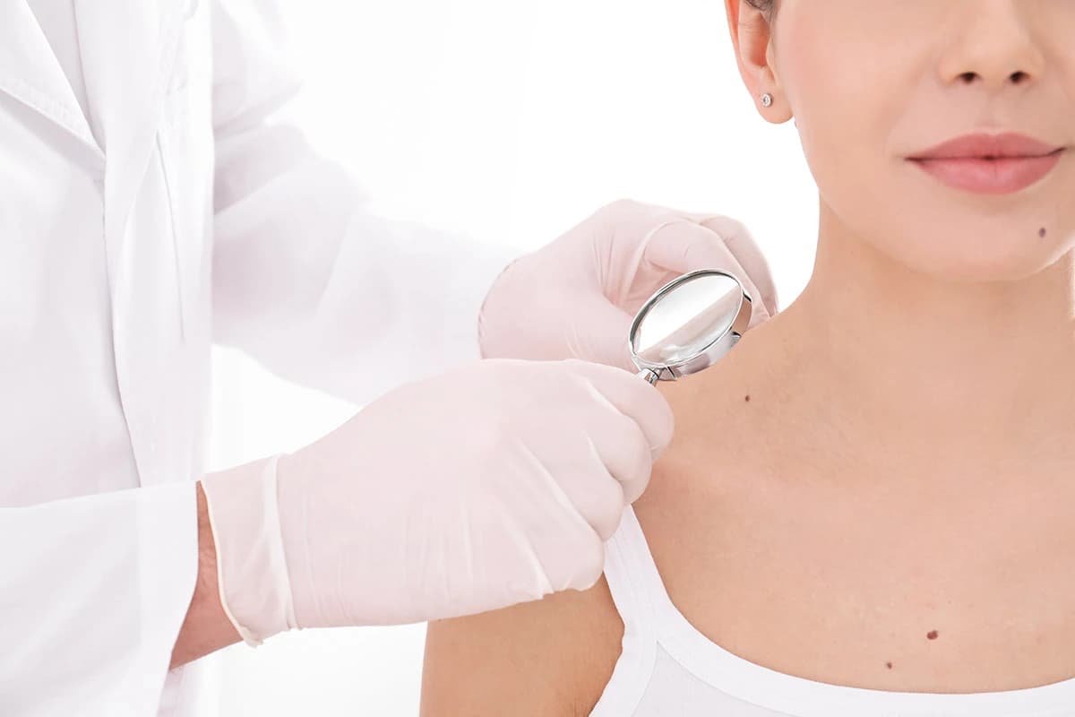 Conocimiento médico en dermatología