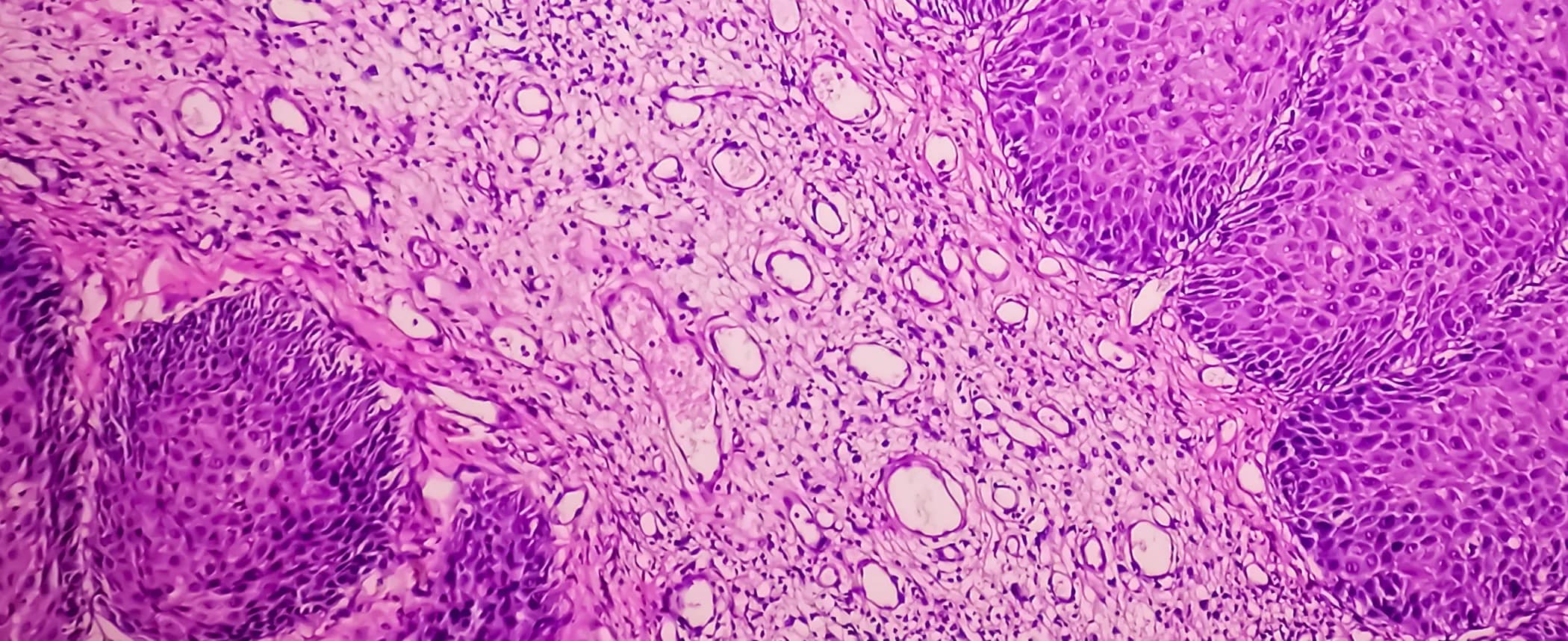 Histología y clínica
