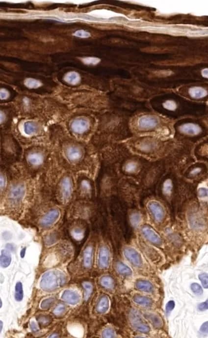 Inmunohistoquímica