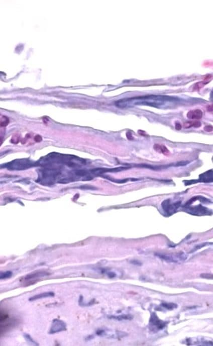 Tinciones especiales (dermatopatología)