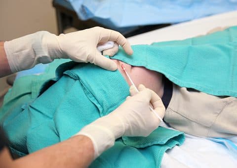 Médico con guantes realizando una biopsia de piel sobre campo quirúrgico