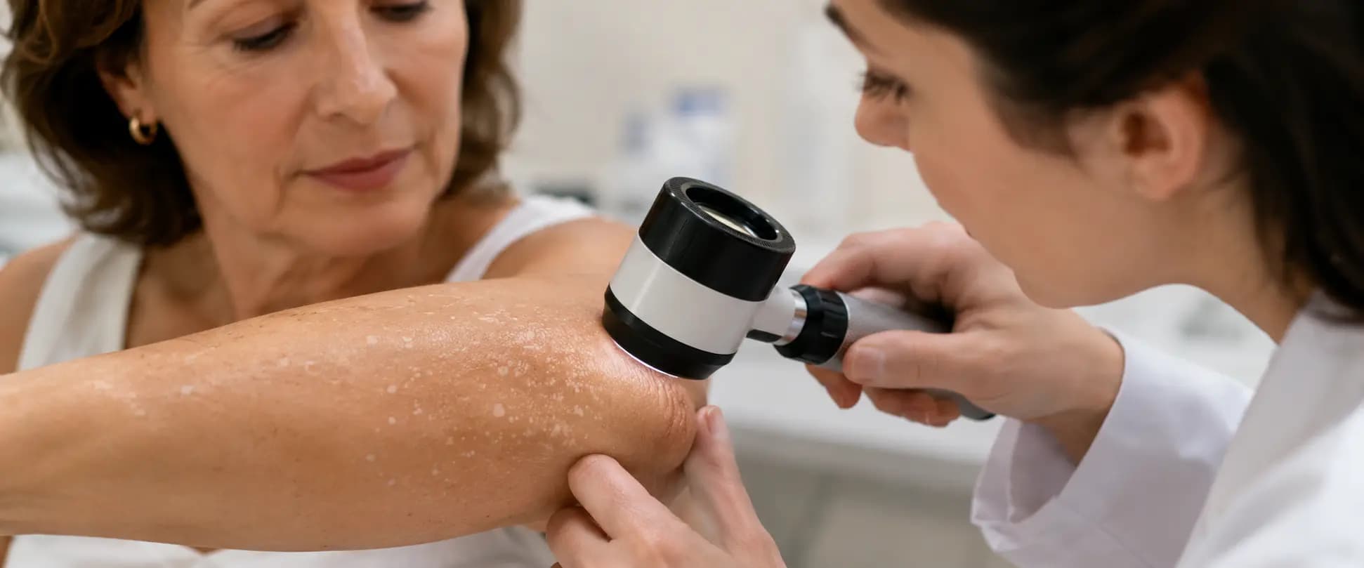 Dermatóloga examina con dermatoscopio lesiones de hipomelanosis guttata en el brazo de una mujer de mediana edad.
