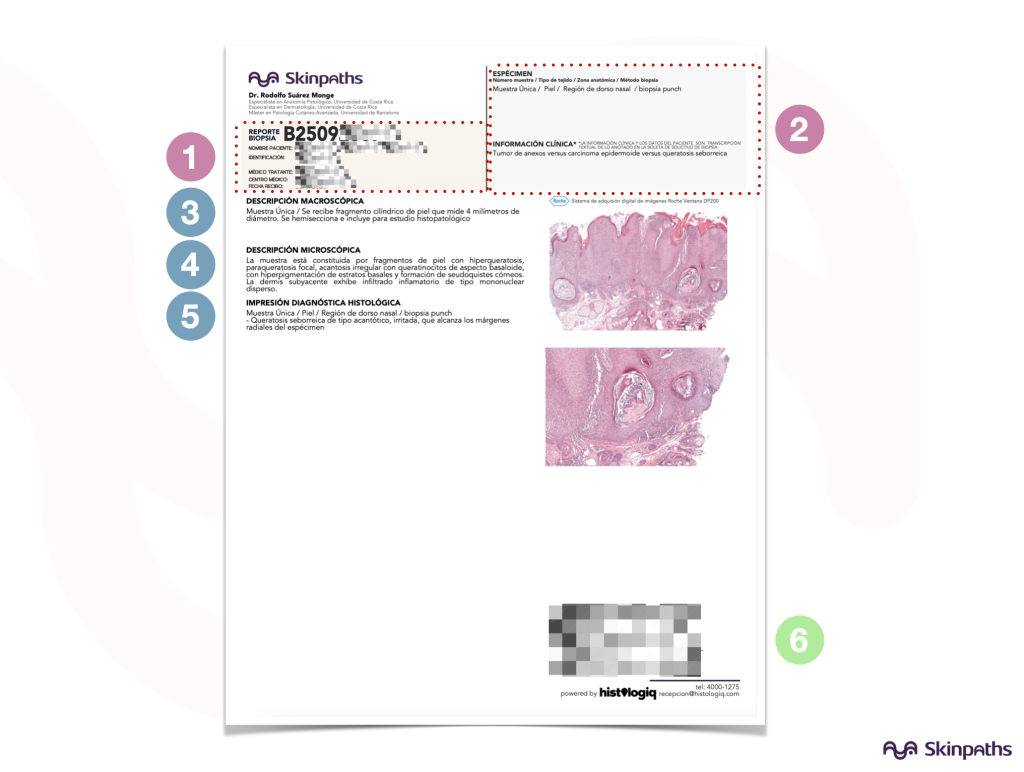 Glosario de biopsia cutánea para dermatólogos | Costa Rica