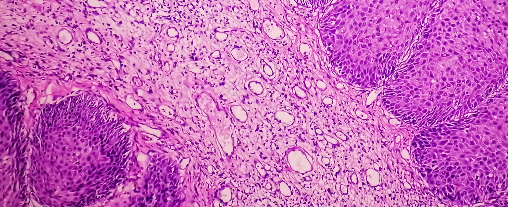 Histología y clínica